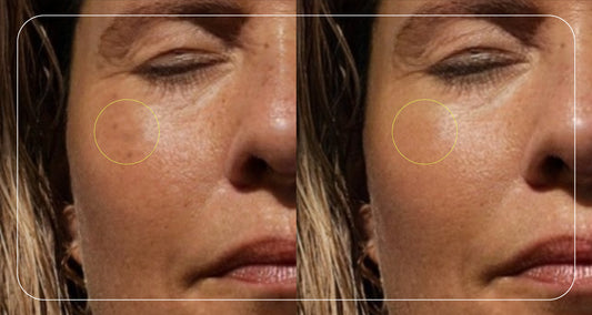 Before/after - anti-aging sunscreen-effects of too much sun exposure - ATTITUDE