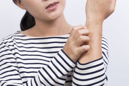 What are the causes of eczema?